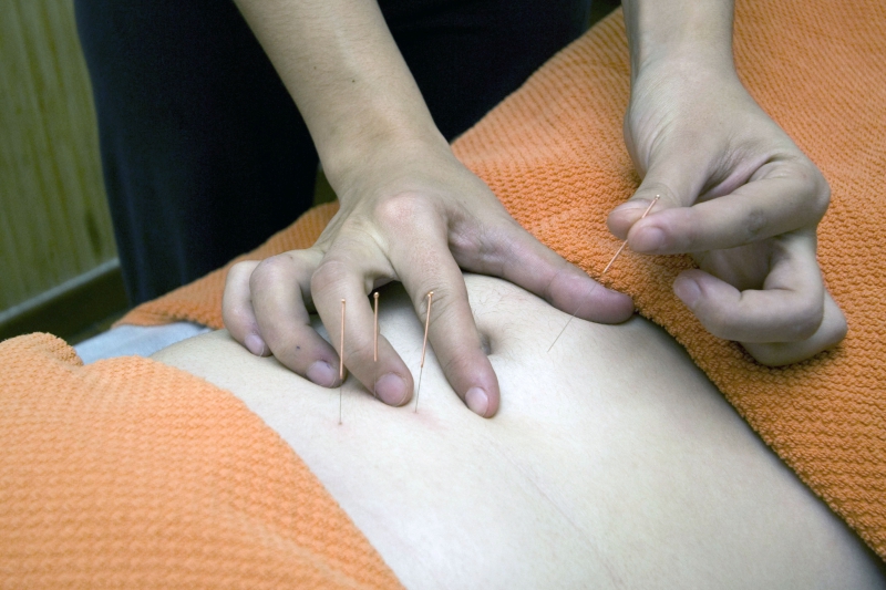 osteopathe-SAUZE-min_acupuncture-4175625